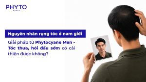 Nguyên nhân rụng tóc ở nam giới và giải pháp từ Phytocyane Men - Tóc thưa, hói đầu sớm có cải thiện được không?