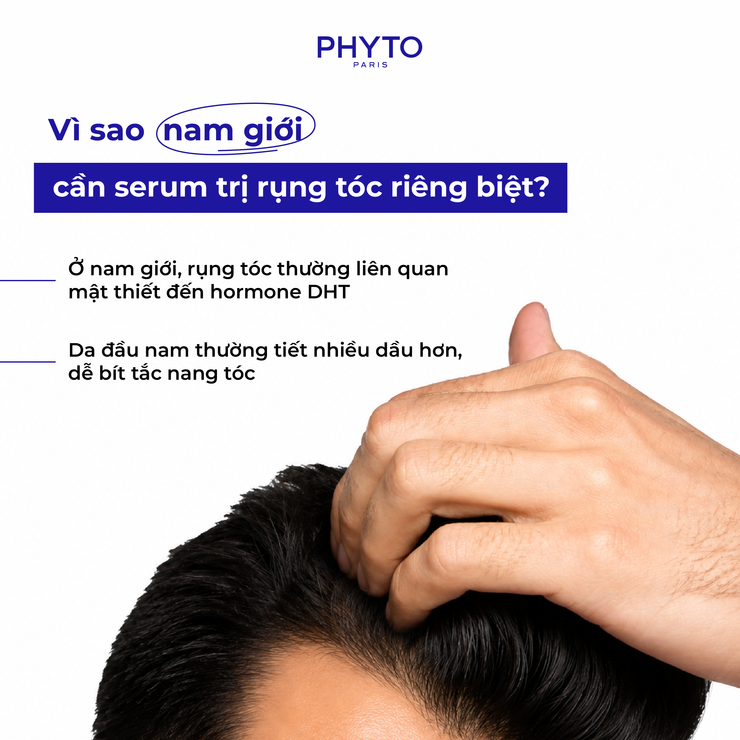 Vì sao nam giới cần serum trị rụng tóc riêng biệt?